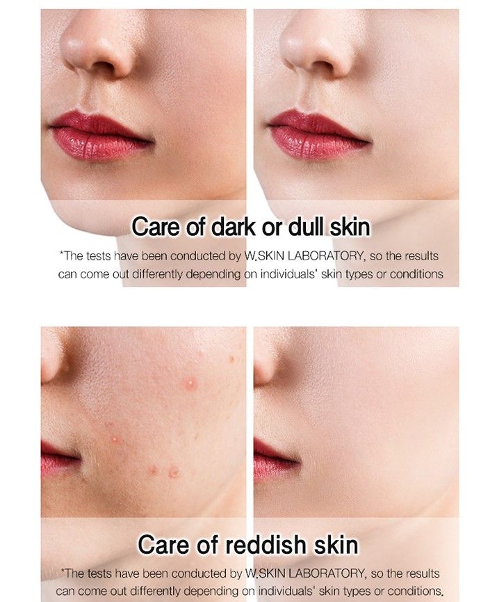 {HÀNG CHÍNH HÃNG} Kem dưỡng trắng da nâng tông tức thì WHITE GLUTATHIONE TONE UP CREAM (60ml) {Có tem phụ nhập khẩu chính ngạch}