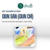  Gói xét nghiệm kiểm tra dị ứng, ngứa (Nhân viên đến lấy mẫu tại nhà) 