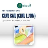  Gói xét nghiệm kiểm tra dị ứng, ngứa (Nhân viên đến lấy mẫu tại nhà) 