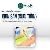  Gói xét nghiệm kiểm tra dị ứng, ngứa (Nhân viên đến lấy mẫu tại nhà) 