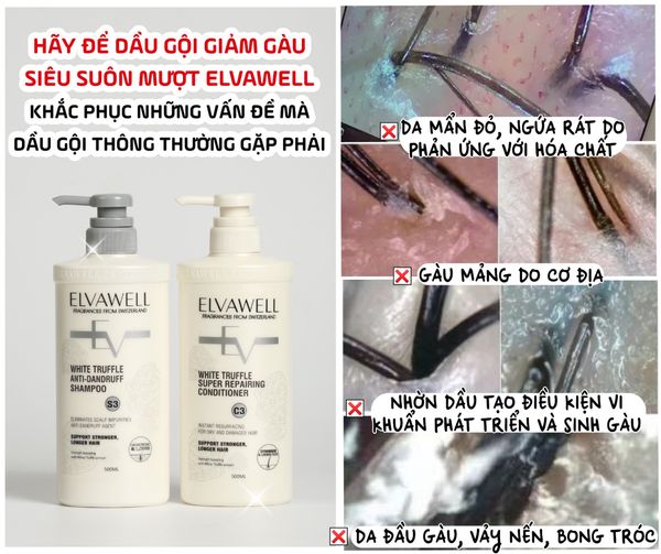  Dầu xả giảm gàu siêu suôn mượt Elvawell 500ml 