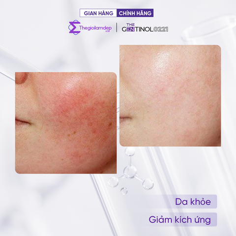 Gel dưỡng phục hồi PANTHENOL 5% GEL CALMING & SMOOTHES SKIN giúp làm dịu và dưỡng ẩm làn da The Gentinol 0221 50g