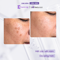 Kem WHITE ON REPAIR CREAM ( white-on repair cream) tái sinh tế bào, khôi phục sự cân bằng da The Gentinol 0221 50g