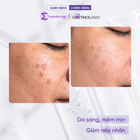 Tinh chất HA siêu phân tử thúc đẩy khả năng tái tạo, phục hồi, trẻ hóa da, dưỡng ẩm, làm mờ vết thâm, hỗ trợ da căng bóng, mịn màng The Gentinol 0221 30ml