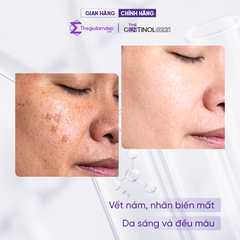 Combo kem phân hủy sắc tố, xử lý nám da, hỗ trợ da trắng sáng mịn màng The Gentinol 0221