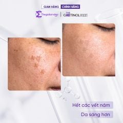 Kem MELA OFF CREAM (mela-off cream) phân hủy sắc tố, xử lý nám da The Gentinol 0221 50gr
