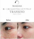  TRANSINO- Viên uống trị nám Transino II (240v) 