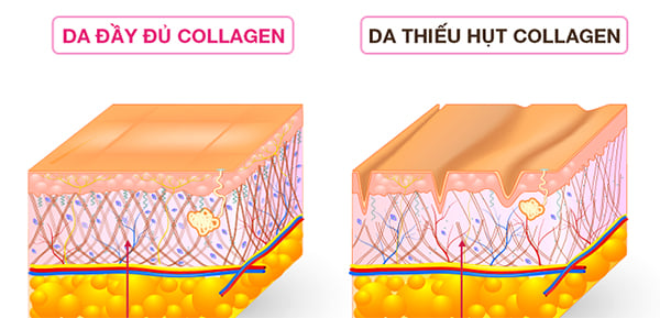 Tác dụng của collagen Nhật lên da