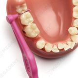  Angle - Bàn chải kẽ răng góc - Bịch 25 cây + 25 nắp đậy 