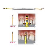  Chu's aesthetic gauge set - satin - Bộ đo làm dài thân răng - Bộ 3 cây và 1 hộp thép 