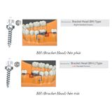  Microimplant - Minivis dùng trong chỉnh nha - Túi 1 cái 