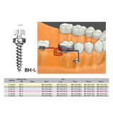  Microimplant - Minivis dùng trong chỉnh nha - Túi 1 cái 