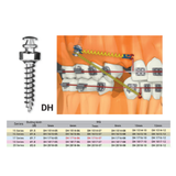  Microimplant - Minivis dùng trong chỉnh nha - Túi 1 cái 