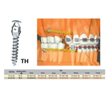  Microimplant - Minivis dùng trong chỉnh nha - Túi 1 cái 