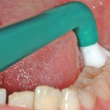  Compact Tuft - Bàn chải đánh răng đầu hình vòm cho người niềng răng, chỉnh nha, răng implant riêng lẻ - Vỉ 1 cây 