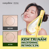 Huyết Thanh Dưỡng Trắng, Cải Thiện Nếp Nhăn Easydew  DW-EGF Retinol 0.3% Melatoning Cream (EXPERT) 1ml