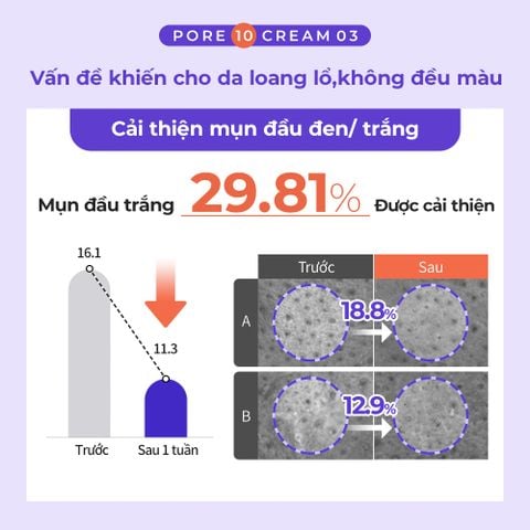 Kem giảm mụn đầu đen - đầu trắng - se khít lỗ chân lông - cấp ẩm Dewycel Pore10 Cream 40ml
