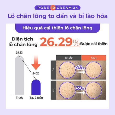 Kem giảm mụn đầu đen - đầu trắng - se khít lỗ chân lông - cấp ẩm Dewycel Pore10 Cream 40ml