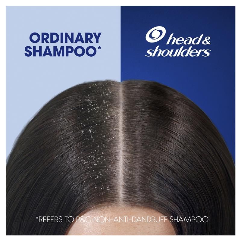 Dầu gội + dầu xả chống gàu Head & Shoulders Ultra Men 2in1 Moisture Recharge 750ml