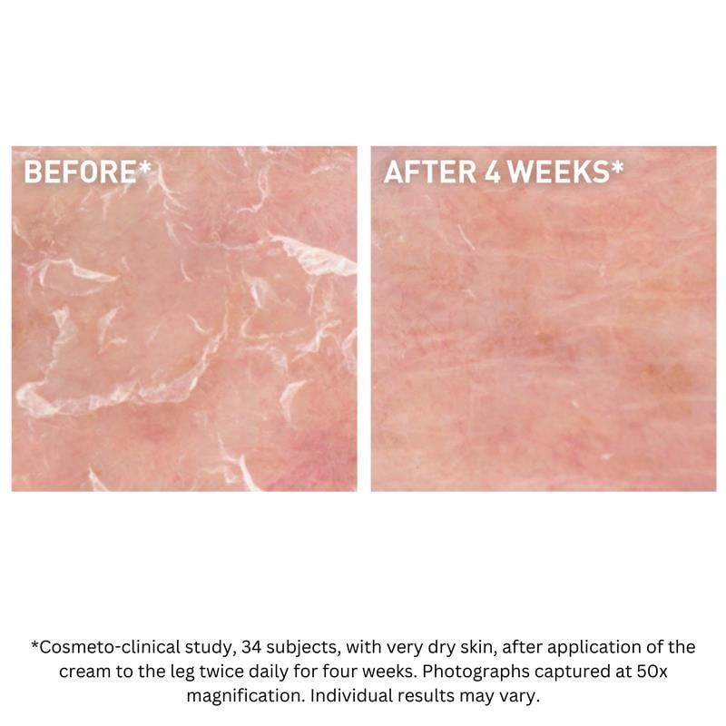 Kem dưỡng ẩm CeraVe 170g