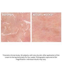 Kem dưỡng ẩm CeraVe 170g