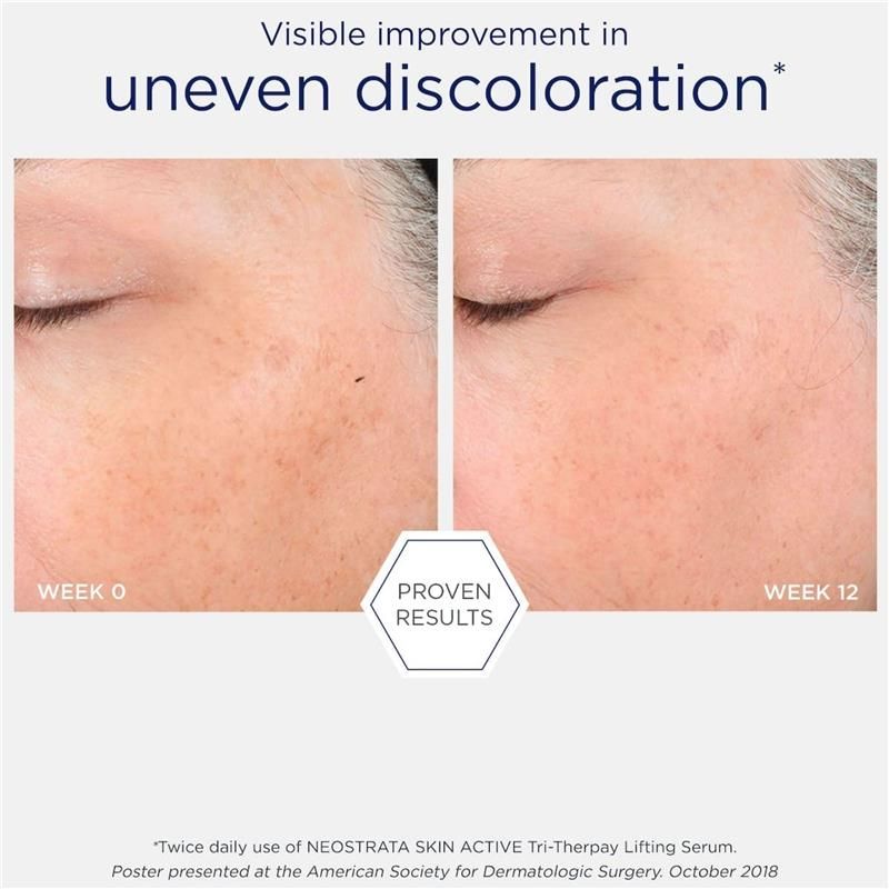 Huyết thanh nâng cơ không mùi Neostrata Skin Active Tri-Therapy 30mL
