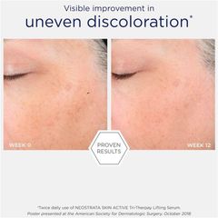 Huyết thanh nâng cơ không mùi Neostrata Skin Active Tri-Therapy 30mL