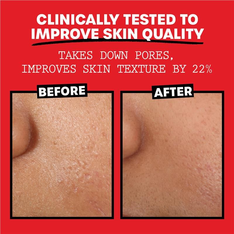 Nước hoa hồng không cồn Thayers Cucumber với chiết xuất cây phỉ lô hội 355ml