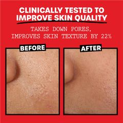 Nước hoa hồng không cồn Thayers Cucumber với chiết xuất cây phỉ lô hội 355ml