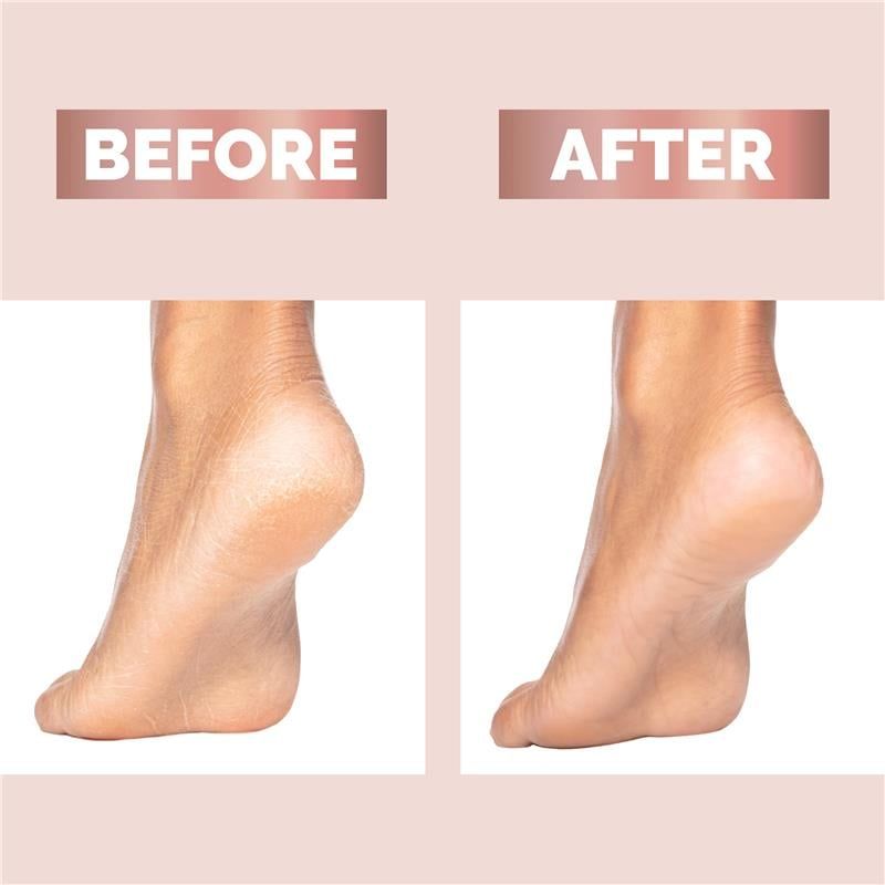 Hoàn thiện hoàn hảo Pedi