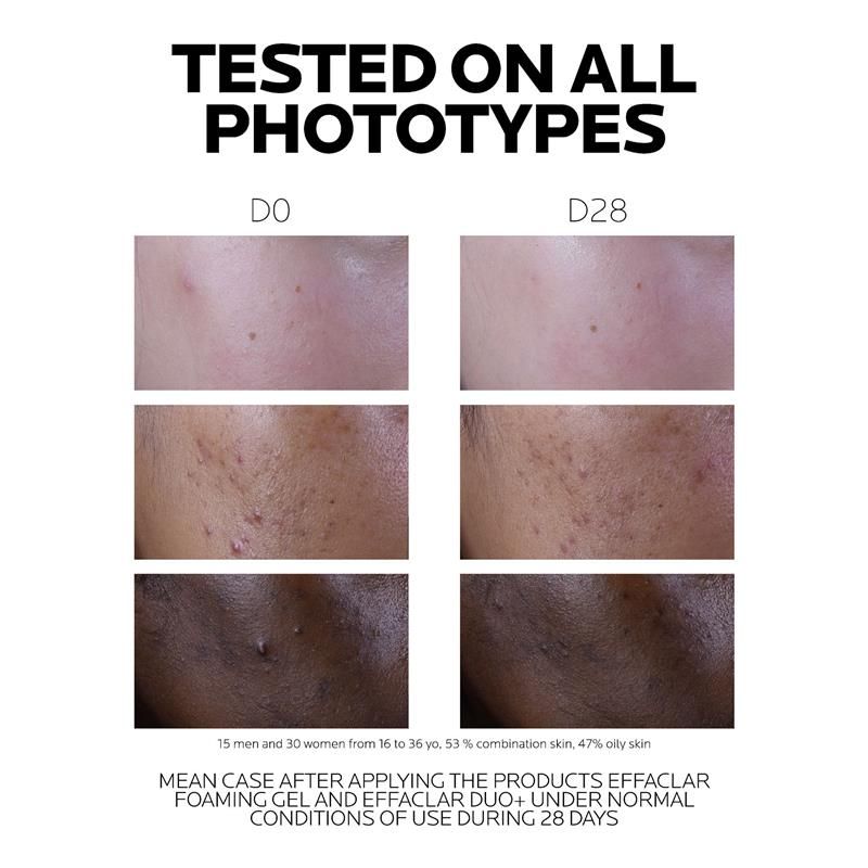 La Roche Posay Effaclar Duo + M 40ml