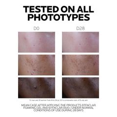 La Roche Posay Effaclar Duo + M 40ml