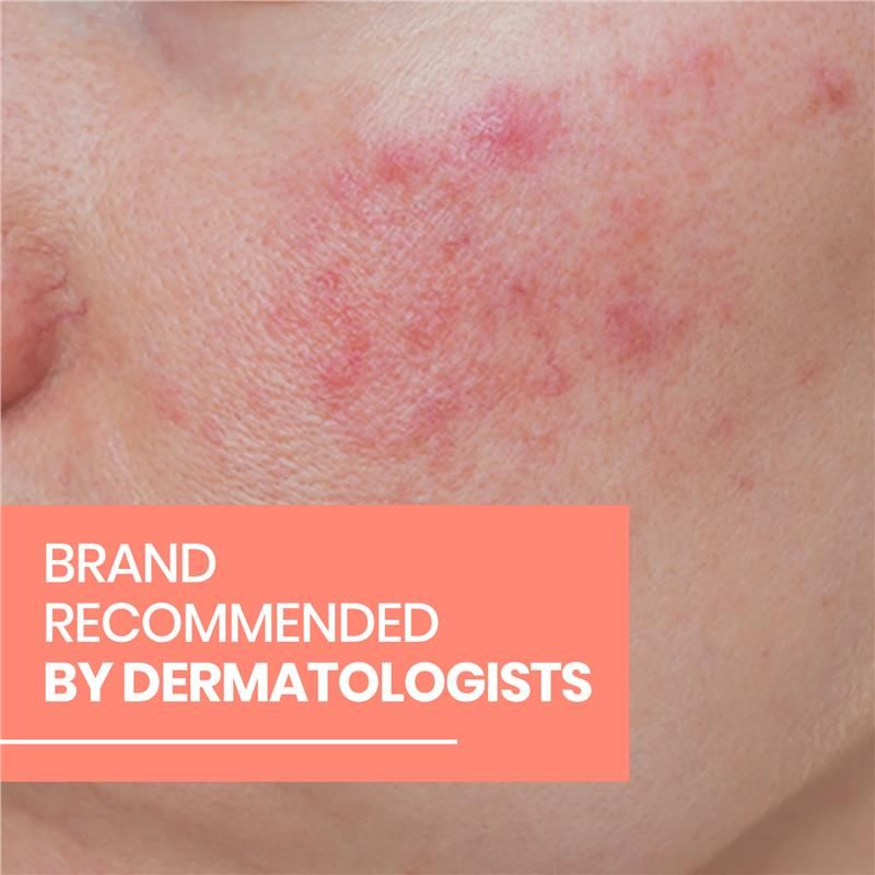 Avene Redness Expert Kem dưỡng ẩm làm dịu da 30ml