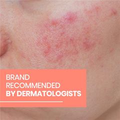 Avene Redness Expert Kem dưỡng ẩm làm dịu da 30ml