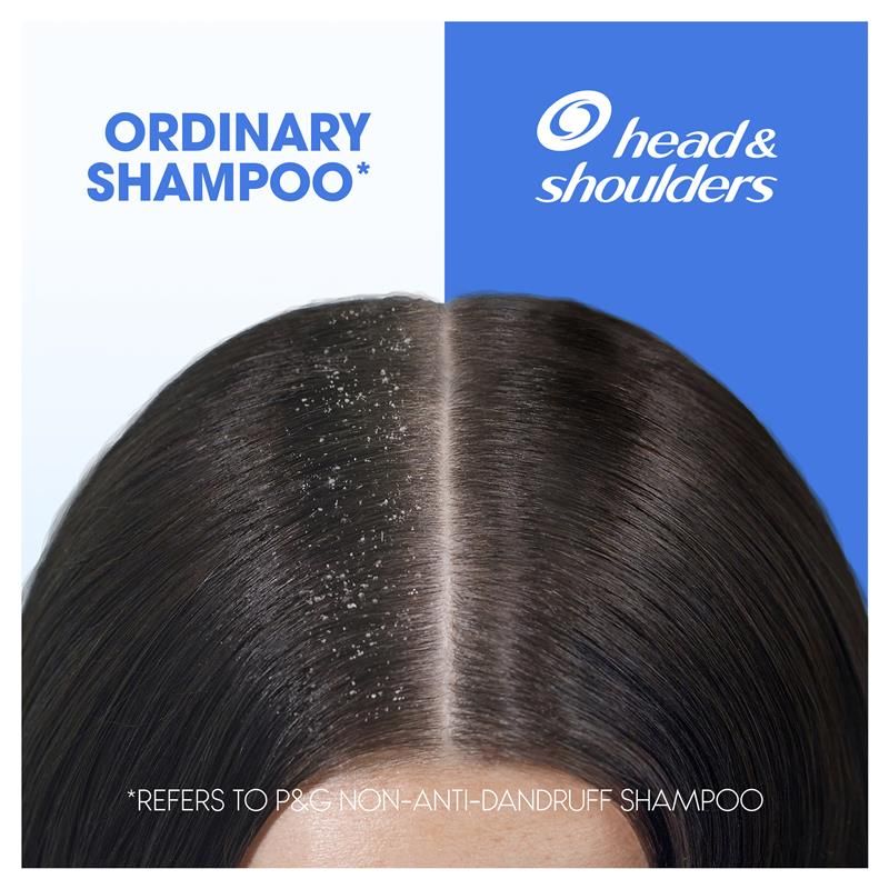 Dầu gội + dầu xả Head & Shoulders Itchy Scalp Care 2in1 750ml