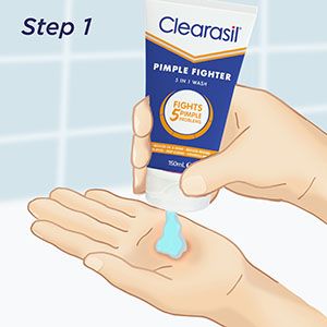 Sữa rửa mặt trị mụn Clearasil Pimple Fighter 5 trong 1 150 ml