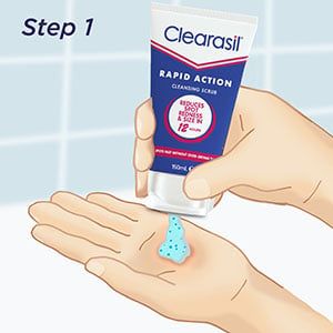 Sữa rửa mặt tẩy tế bào chết Clearasil Ultra Rapid Action 150 ml