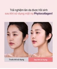 Hộp 5 Mặt Nạ Giúp Dưỡng Da Chuyên Sâu Luvum Gel Mask 33g/miếng (Mặt Nạ Thạch Dẻo), Mặt nạ thạch Luvum Mask