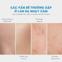 Mặt nạ dưỡng ẩm và làm dịu da Pakupaku Soothing Moist Sheet Mask 25mlx5