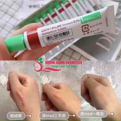 Kem Dưỡng Gentacin Nhật Hỗ Trợ Làm Mờ Sẹo Lồi Lõm 10g