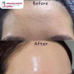Serum Dưỡng Trắng Và Phục Hồi Da K Lady Care Bakuchiol Retinol 50ml