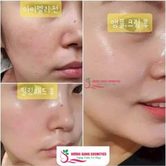 Serum Collagen Tươi JM Collagen Multi Vita Capsule Ampoule Vỉ 12 viên