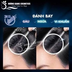 Dầu gội trị sạch gầu Clear Hương Chanh Bạc Hà 400ml Thái Lan