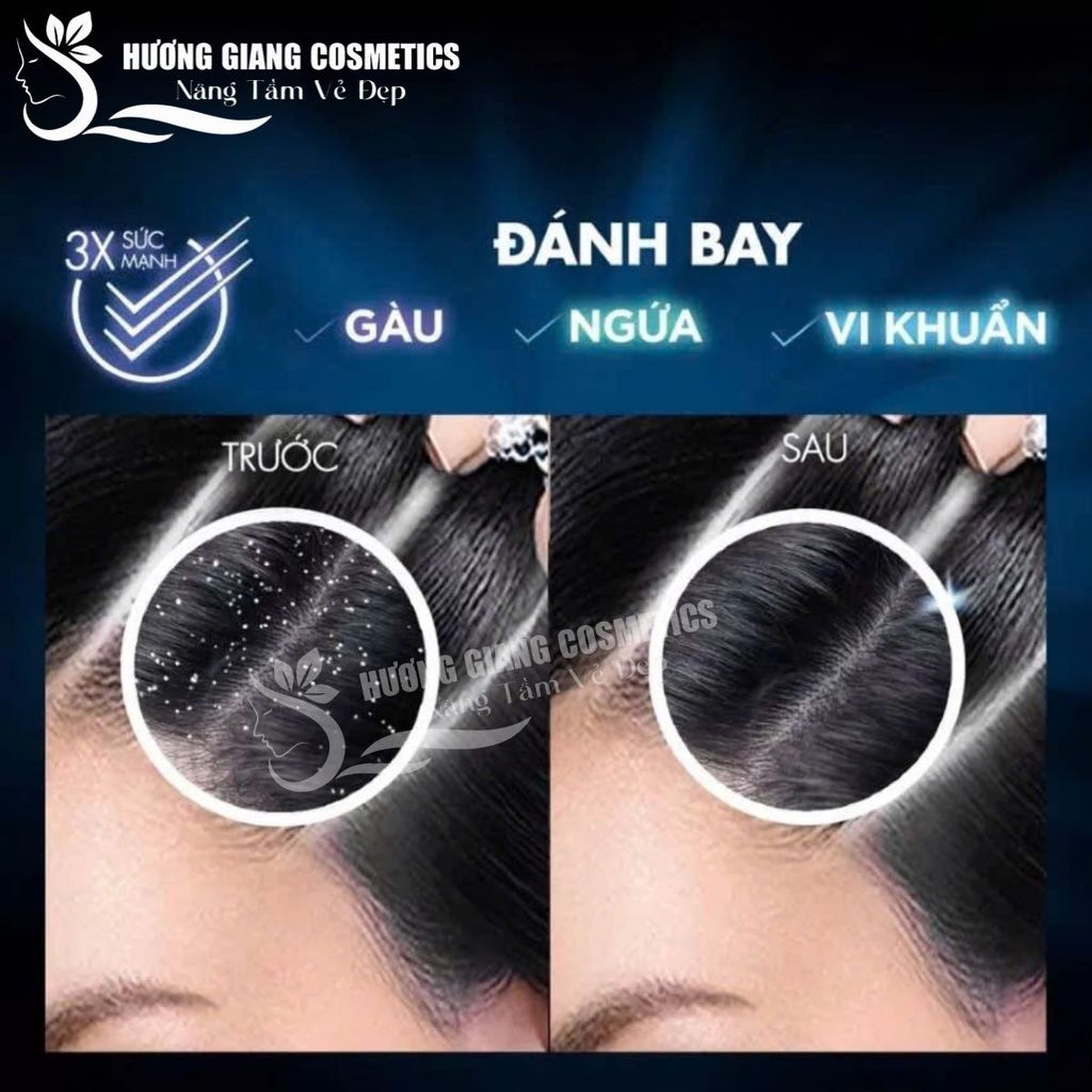 Dầu Gội Trị Gàu Clear Men Hương Bạc Hà  390 ml Thái Lan