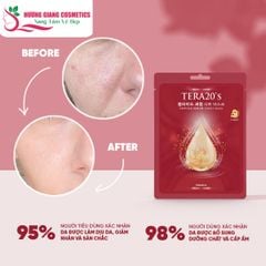 Mặt Nạ Dưỡng Da Serum Tinh Chất Peptide TERA20’s Chống Lão Hóa Da
