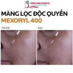 Kem Chống Nắng La Roche-Posay Anthelios UVMUNE 400 SPF50+ 50ml