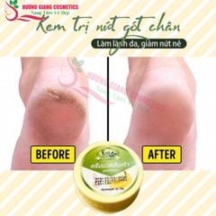 Kem chuối Trị Nứt Gót Chân Banana Cream Heel Thái Lan 50ml
