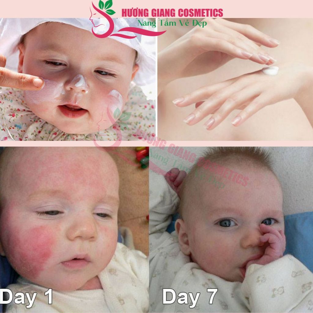 Kem nẻ Pháp glycerol Vaseline paraffine creme 250g