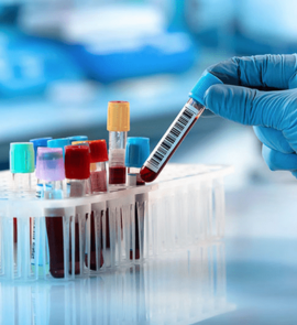  Dịch vụ xét nghiệm Huyết Học 