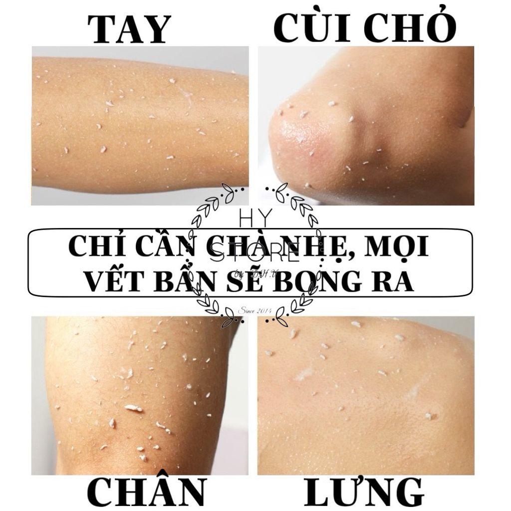 Gel tẩy tế bào chết